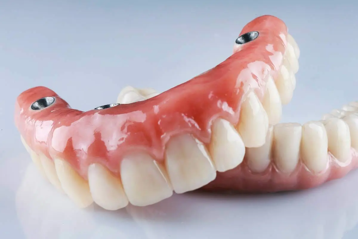 Prótesis dentales