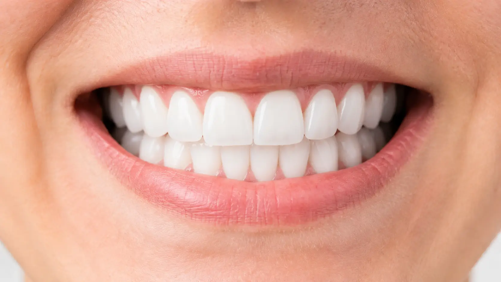 Después del tratamiento dental